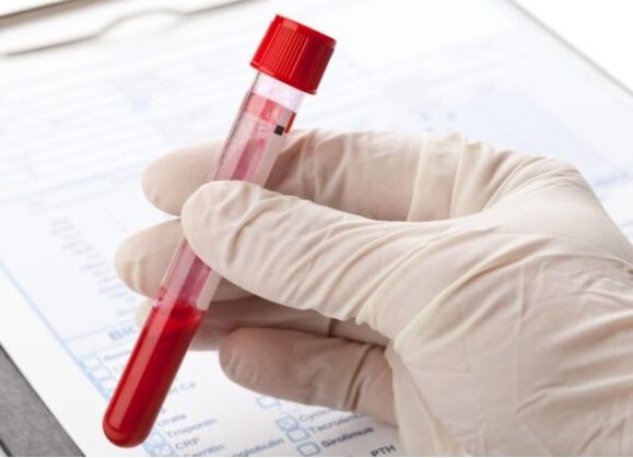Laboratórne diagnostické metódy vám umožňujú identifikovať patologickú mikroflóru alebo vírus